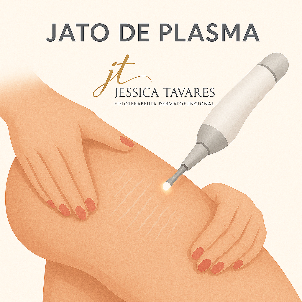 JATO DE PLASMA