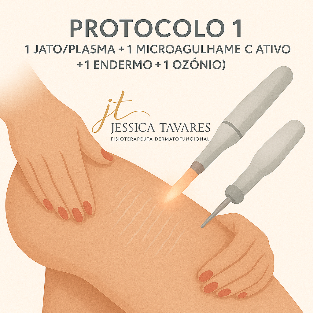 PROTOCOLO 1 (1 JATO/PLASMA + 1 MICROAGULHAMENTO C/ ATIVO + 1 ENDERMO + 1 OZONIO)