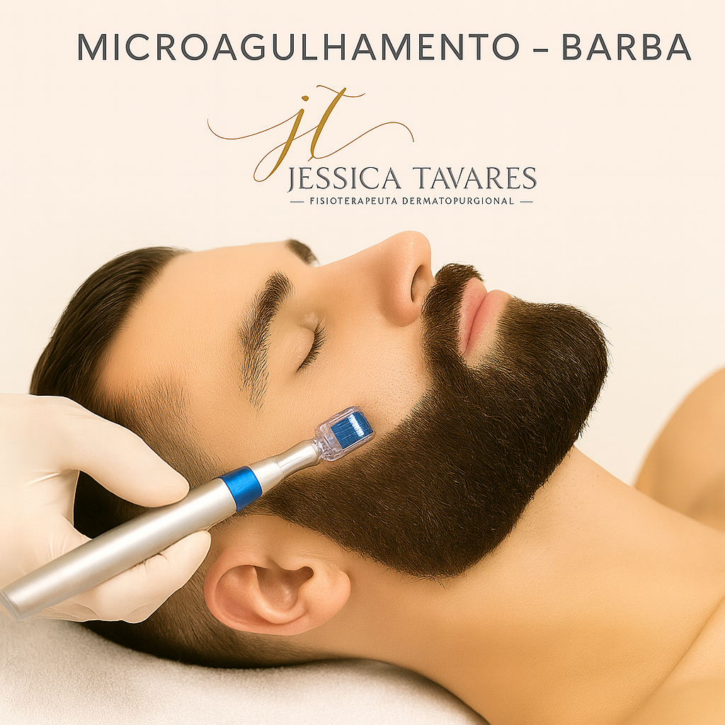 MICROAGULHAMENTO – BARBA