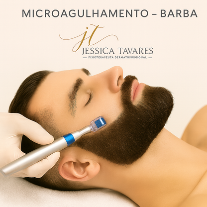 MICROAGULHAMENTO – BARBA