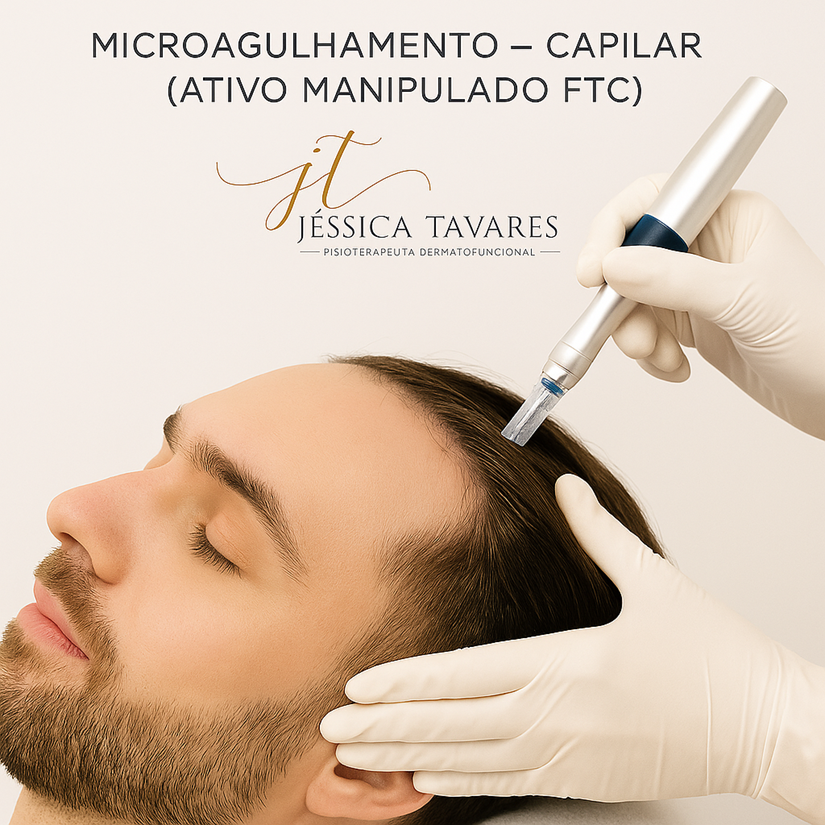 MICROAGULHAMENTO - CAPILAR (ATIVO MANIPULADO FTC)